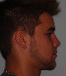 end profile