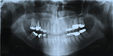iniital pan