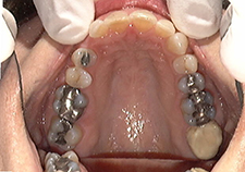 iniitial