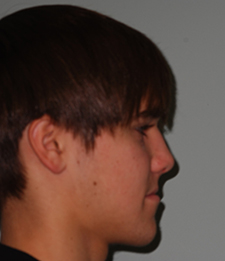 initial profile